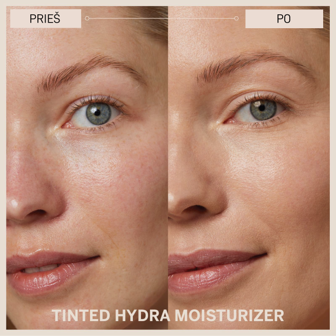 BABOR_Tinted hydra moisturizer_prieš ir po