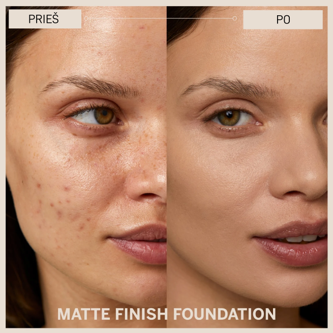 BABOR_Matte finish foundation_Prieš ir po